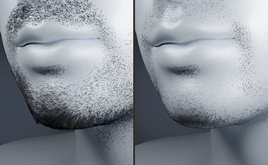 Szakálltípus-felismerő intelligencia